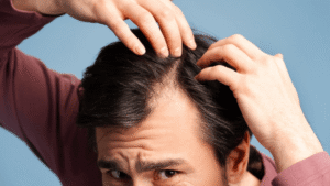 ciclo de vida de cabello
