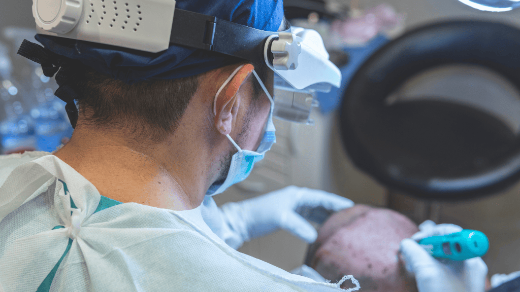 Procedimiento de injerto capilar realizado por equipo médico